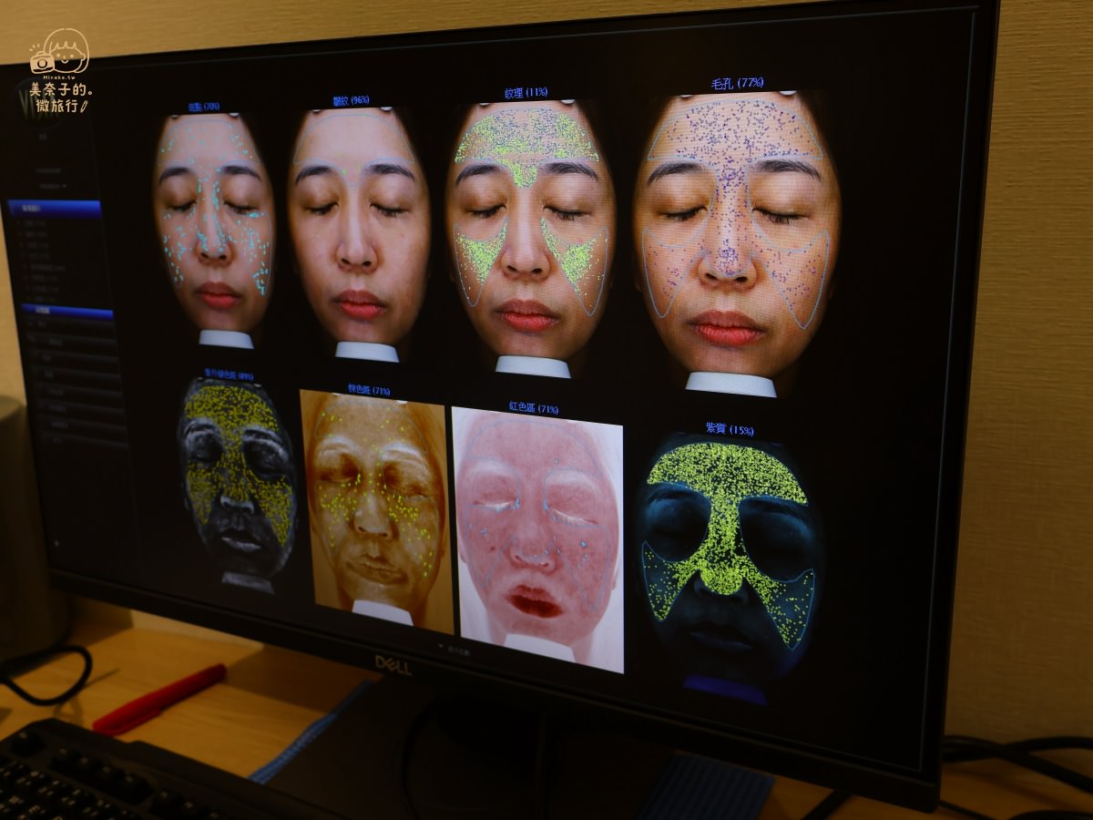 皮秒醫美藏琢診所全臉檢測儀結果