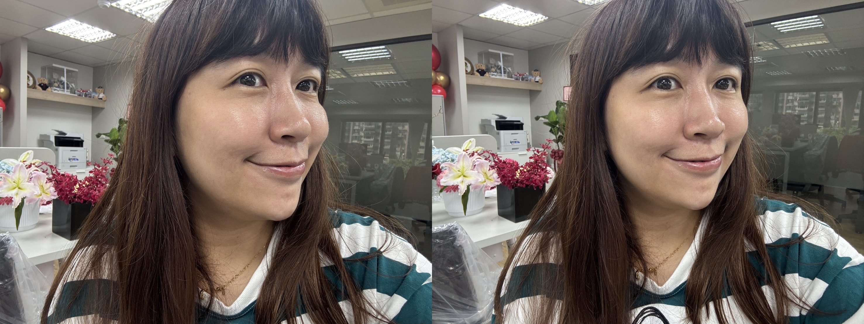 韓國首爾明洞Heyday皮膚科醫美音波術後