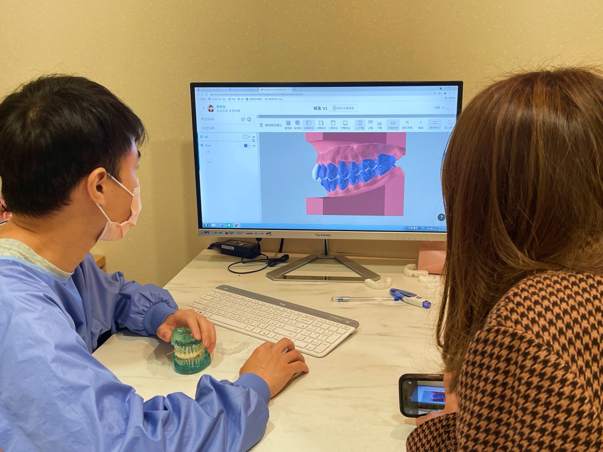 SOV 最爽的地方：可以先看到「矯正完的樣子」