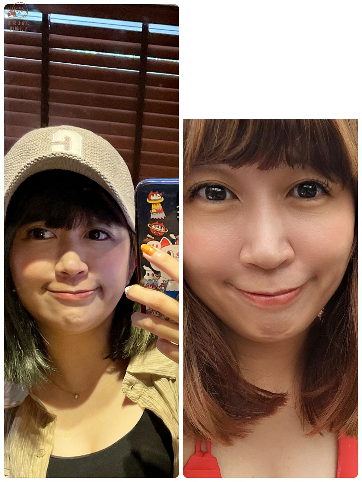 SOV隱形牙套》暴牙矯正總整理:牙齒矯正前後對比,如何維持注意事項 - 第8張圖 SOV隱形牙套矯正笑容