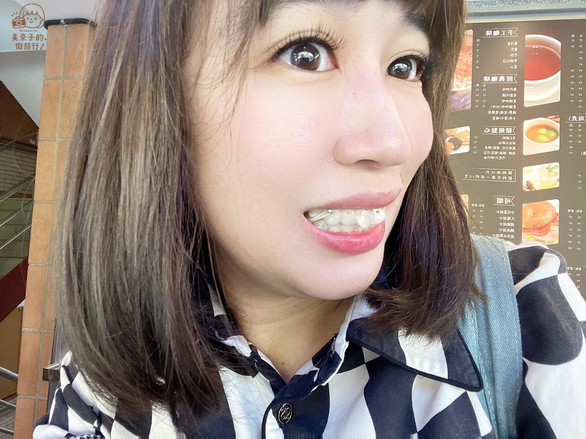SOV隱形牙套》暴牙矯正總整理:牙齒矯正前後對比,如何維持注意事項 - 第1張圖 SOV隱形牙套矯正總整理| 開始矯正的起源