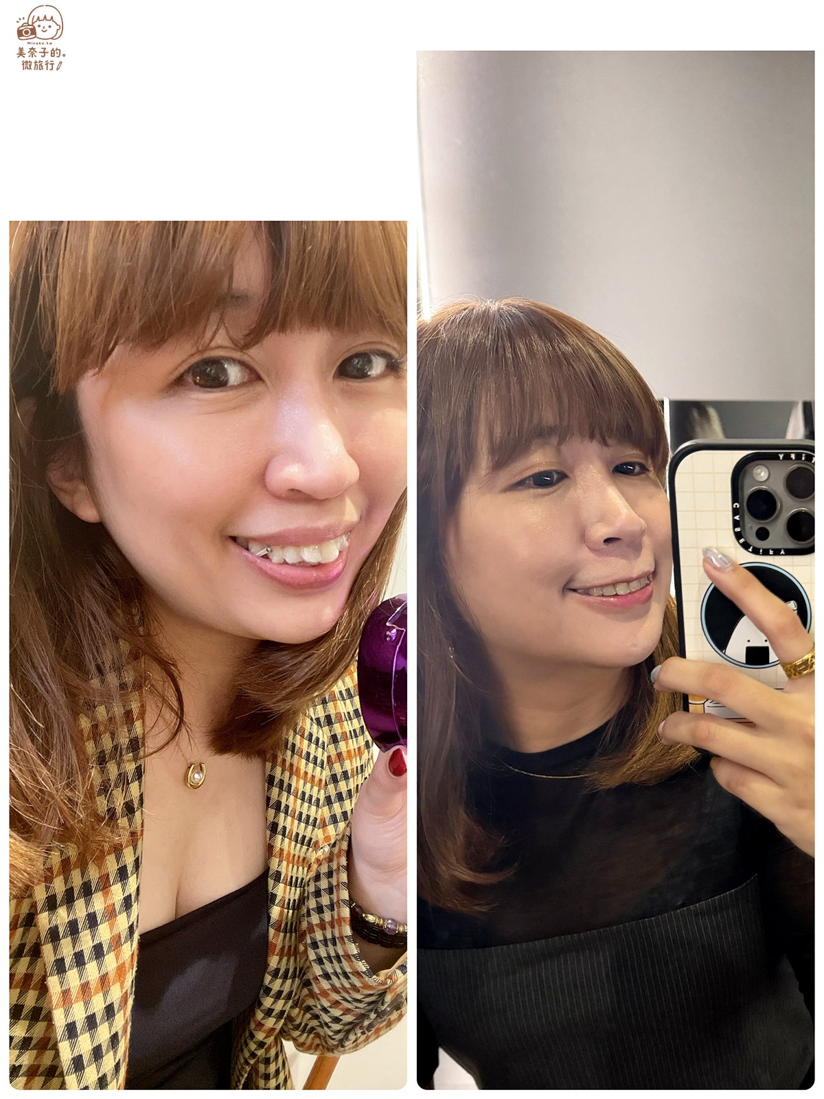 SOV隱形牙套》暴牙矯正總整理:牙齒矯正前後對比,如何維持注意事項 - 第7張圖 SOV隱形牙套暴牙矯正前後比對